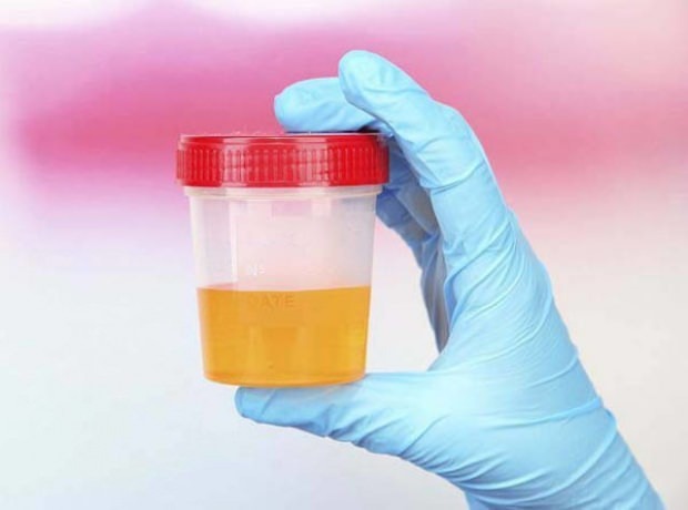 Test de sarcină cu urină