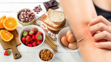 Ce este o alergie alimentară? Cine are alergii alimentare și care sunt simptomele?