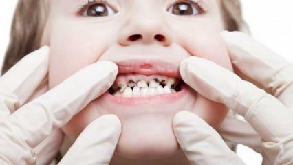 Faceți îngrijirea dentară a copilului dumneavoastră în timpul semestrului!