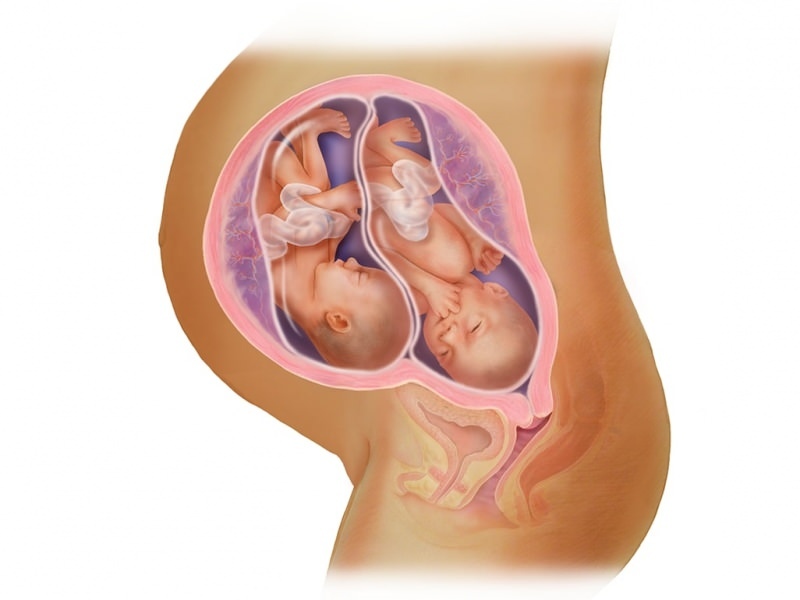 Sarcina dublă în FIV! Ce este transferul de embrioni?