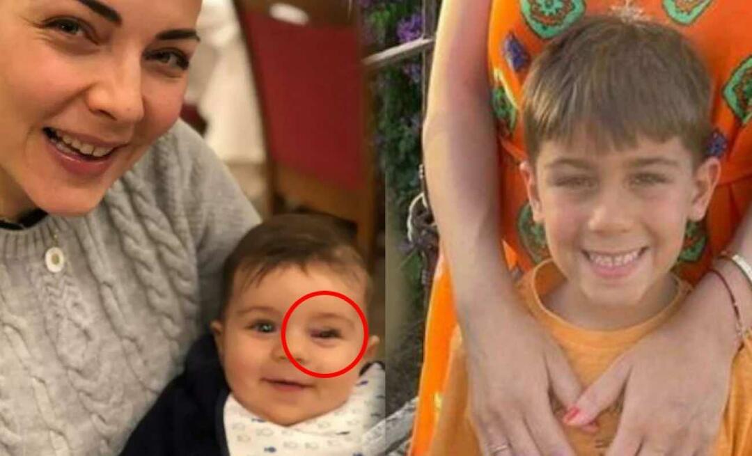 Burcu Kara și-a anunțat boala fiului ei! Umflarea ochiului este un semn al unei tumori...