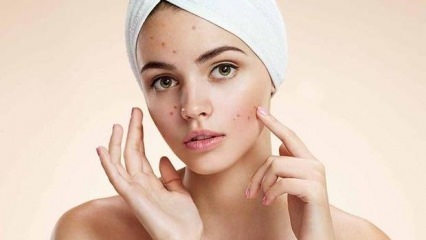 Pastilele pentru acnee sunt dăunătoare?