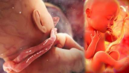 Ce este o înțelegere a cordului? Înfășurarea cordului în jurul gâtului copilului în pântecele mamei