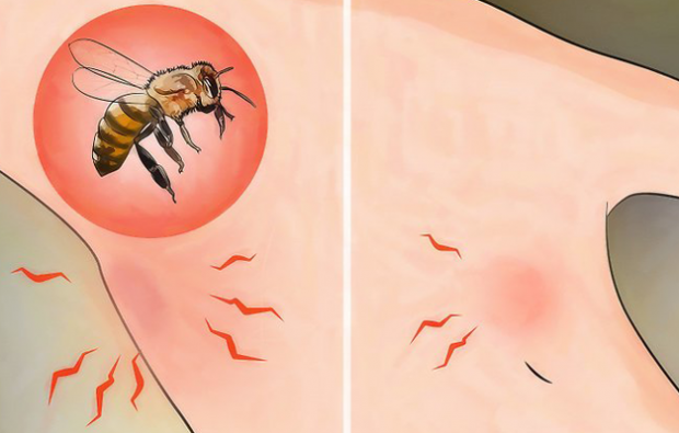 Ce este alergia la albine și care sunt simptomele? Metode naturale care sunt bune pentru înțepăturile de albine