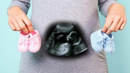 Sexul bebelușului va fi stabilit în primul trimestru de sarcină?