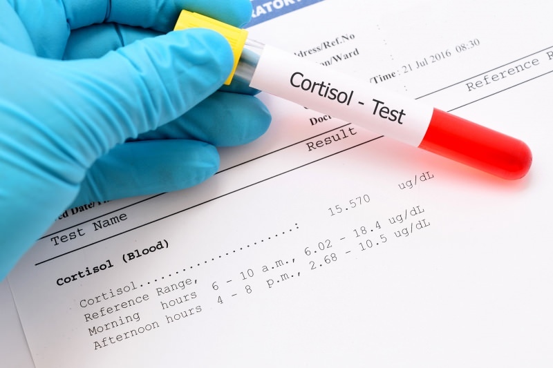 nivelul de cortizol apare în testele de sânge
