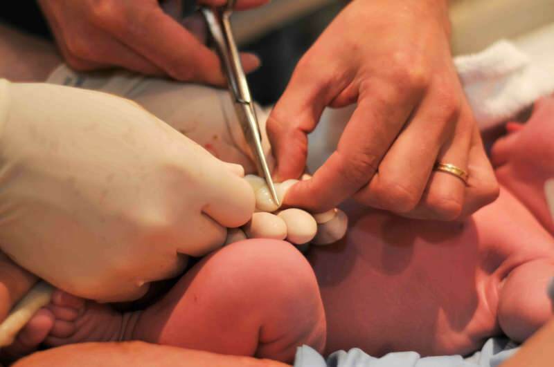 Când trebuie tăiat cordonul ombilical la bebeluși?