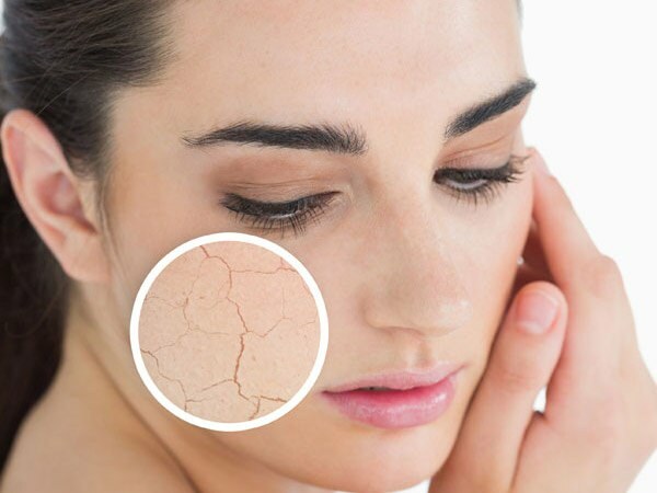 De ce se usucă pielea? Ce să faci pe pielea uscată? Cele mai eficiente recomandări de îngrijire pentru pielea uscată