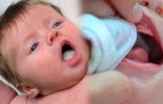 Cum durere o gură la bebeluși