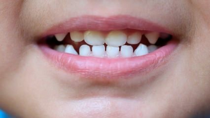 Cum să înveți copiii îngrijiri dentare?