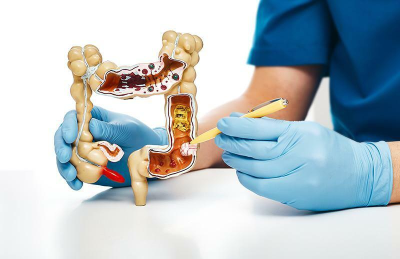 tratamentul obstrucției intestinale la adulți