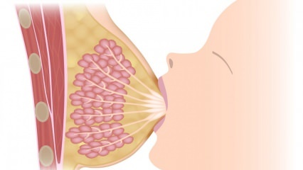 Ce este mastita (inflamația sânilor)? Simptome de mastită și tratament în timpul alăptării