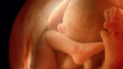 Nu arată genul bebelușului la ultrasunete! Cum arată băieții și fetele la ultrasunete?