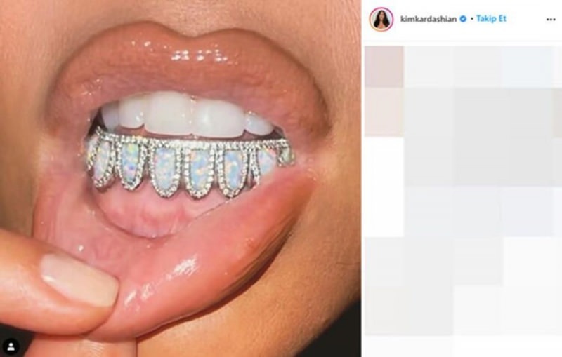 Bijuteria dentară a lui Kim Kardashian, de 5.000 de dolari