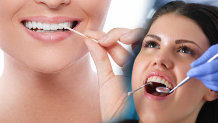 Cum să menții sănătatea orală și dentară? Ce trebuie luat în considerare la curățarea dinților?