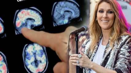 Ce este sindromul persoanei rigide? Celine Dion
