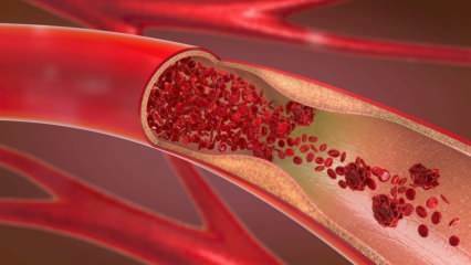 Ce este Anemia (Anemia)? Care sunt simptomele anemiei? Alimente care sunt bune pentru anemie ...
