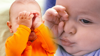 Soluții naturale pentru arsura ochilor la bebeluși