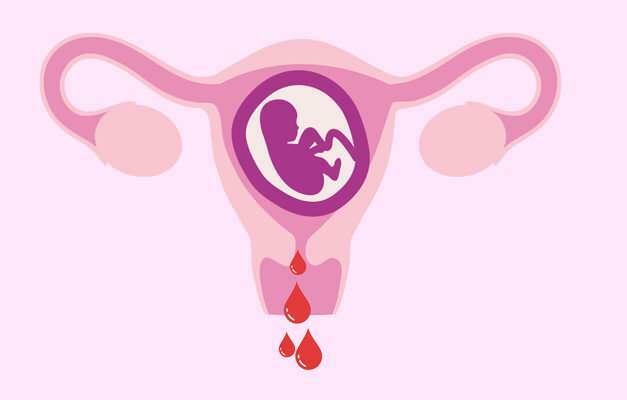 cauzele sângerării în timpul sarcinii
