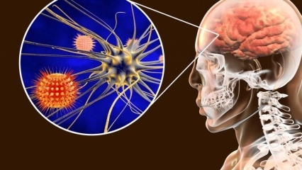 Ce este meningita și care sunt simptomele? Există un tratament pentru meningită?