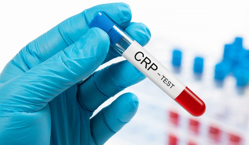 De ce crește CRP în sânge? Ce este CRP? Cum se reduce CRP-ul?