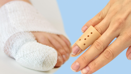 Ce provoacă ruperea degetelor? Care sunt simptomele ruperii degetelor?