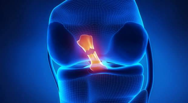 Ce provoacă ruperea ligamentului cruciat și care sunt simptomele? Există un tratament cu ligamente cruciate?