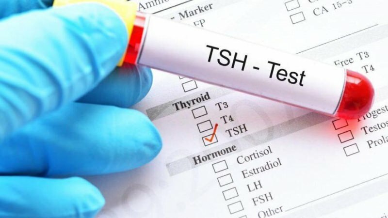 testul tsh este un test hormonal
