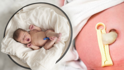 Ce este Placenta Previa? Cum se face îngrijirea cordonului ombilical la bebeluși? Dacă cordonul ombilical este lung ...