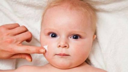 Sfaturi de îngrijire a pielii pentru bebeluși! Care sunt problemele de piele la bebelusi?