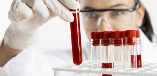 Nivelul hemoglabinului este verificat prin test de sânge