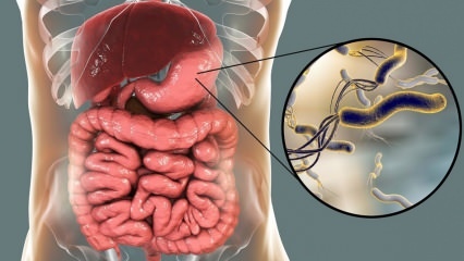 Ce este Helicobacter Pylori (microbul stomacului)? Boli cauzate de Helicobacter Pylori ...