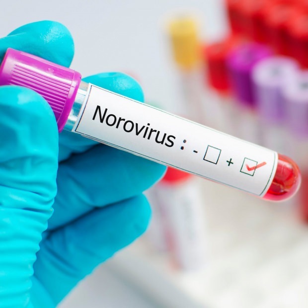 Ce este norovirusul și ce boli cauzează? Necunoscut despre infecția cu Norovirus ...