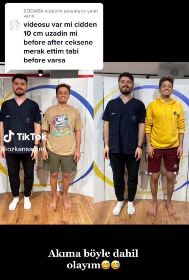 Özkan Sağın a făcut-o înainte și după operație