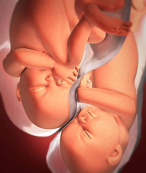 Care sunt simptomele sarcinii gemene?
