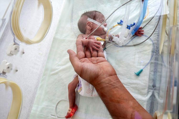 „Bebelușul Miracol” a reușit să supraviețuiască unei intervenții chirurgicale