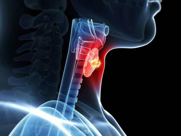 Hashimato perturbă glandele tiroidiene