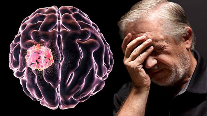 Țesutul format în creier prin perturbarea structurilor celulare se numește tumoare.