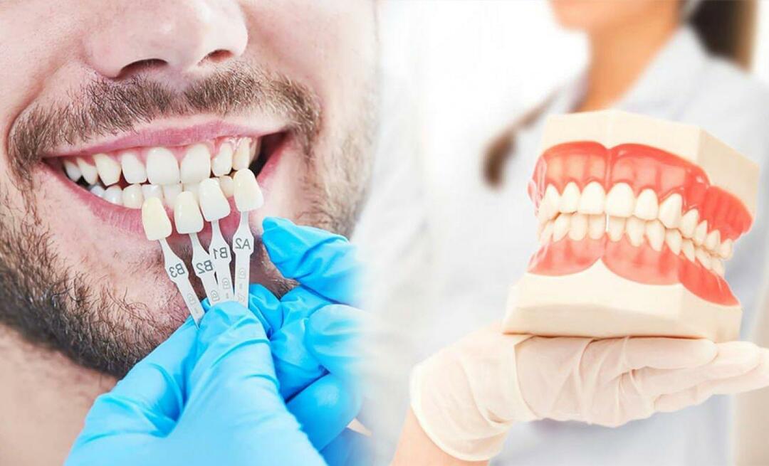 De ce se aplică furnirul de zirconiu pe dinți? Cât de rezistent este stratul de zirconiu?