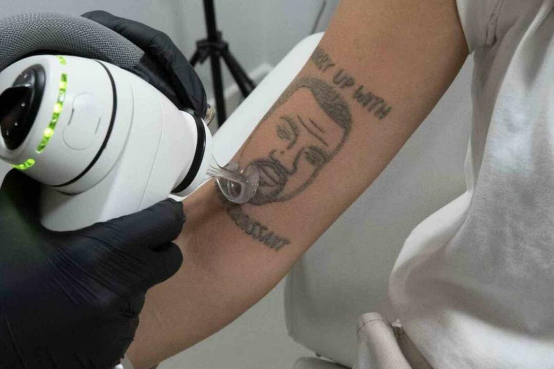 Tatuajul Kanye West va fi eliminat gratuit la Londra 