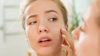 De ce se usucă pielea? Ce să faci pe pielea uscată? Cele mai eficiente recomandări de îngrijire pentru pielea uscată