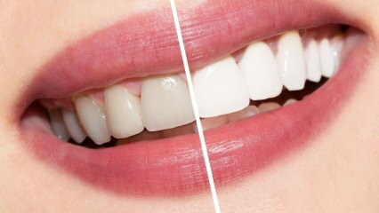 Care sunt recomandările pentru dinții albi? Cura de albire a dinților în mod natural acasă ...