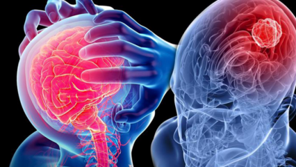 Ce este degenerarea cerebelului (maduva spinarii)? Care sunt simptomele cerebelului (măduva spinării)?