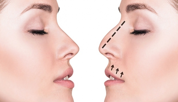 Lucruri de luat în considerare în estetica nasului