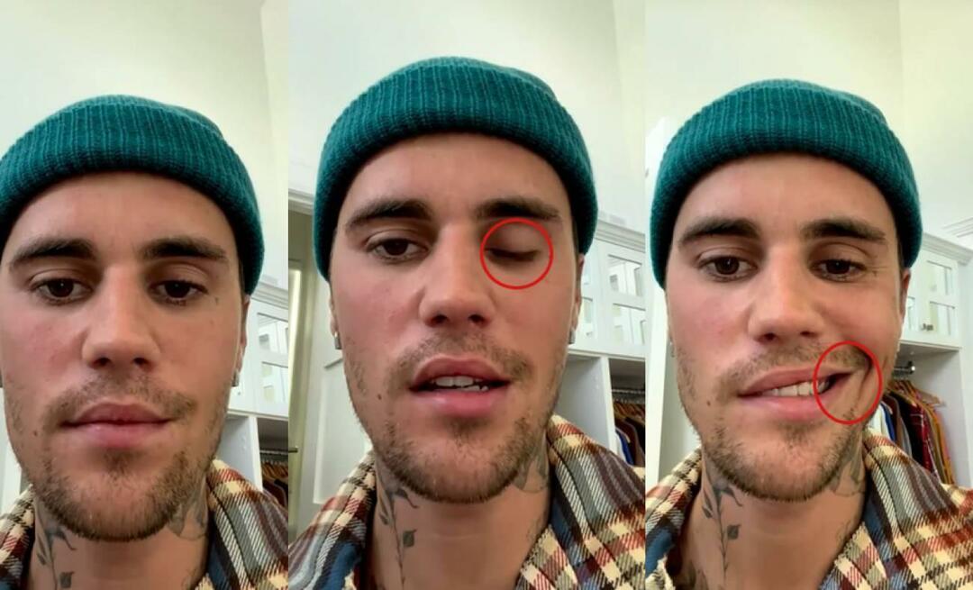 Justin Bieber a suferit o paralizie facială! Celebra vedetă nu poate merge din nou într-un turneu mondial
