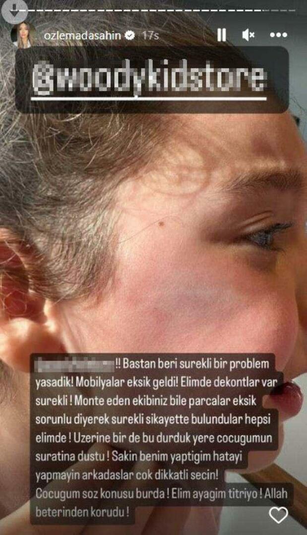 Ușa dulapului a căzut pe fața fiicei lui Berkay Şahin