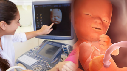 Ce organ se dezvoltă mai întâi la copii? Dezvoltarea bebelușului săptămână de săptămână
