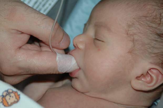 Care este metoda Finger Feeding? Cum să hrănești bebelușul cu o seringă?