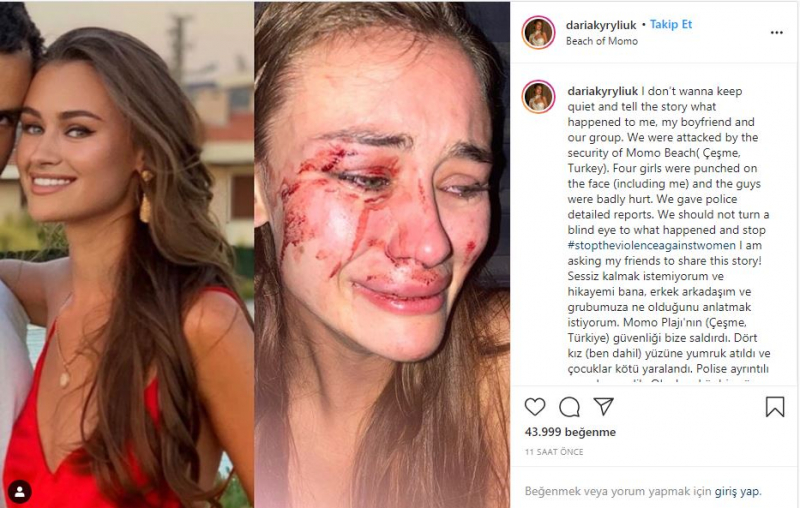 Daria Kyryliuk, cel mai bun model de top din Ucraina, presupus atacat în İzmir Çeșme, a vorbit pentru prima dată!