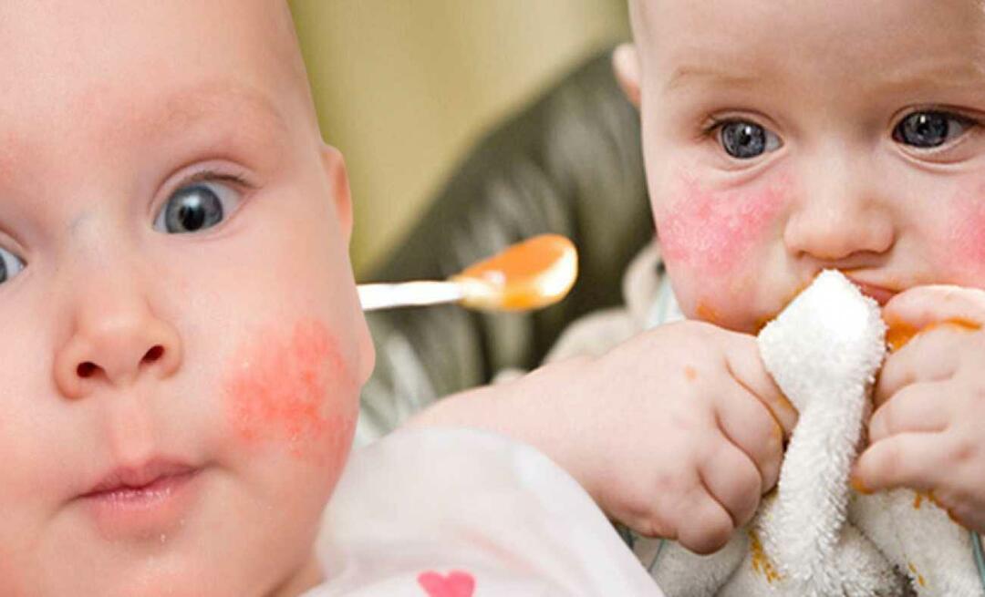 Ce ar trebui să mănânce un copil cu alergii? Care sunt alimentele alternative pentru bebelușii alergici?
